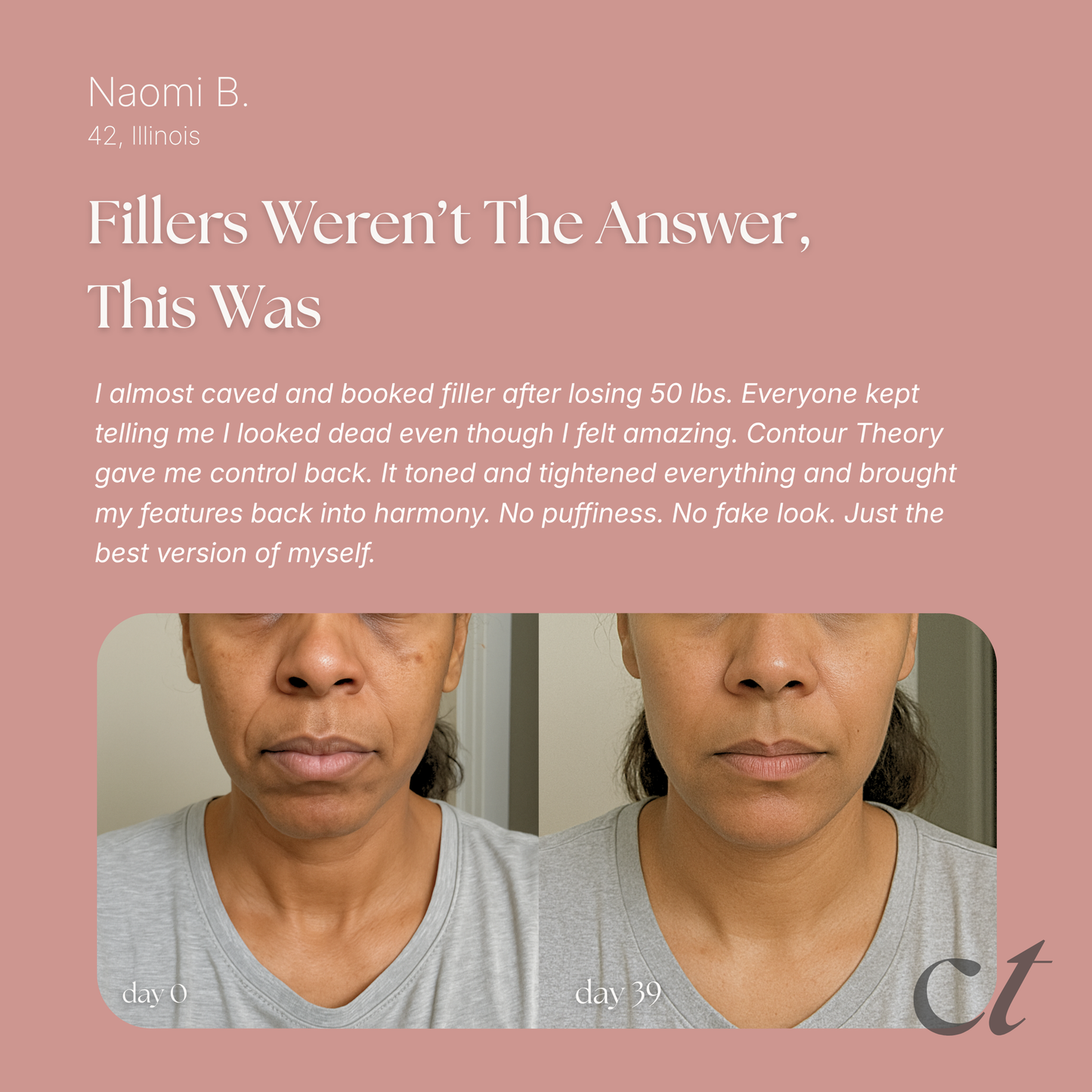 contour theory™ complete lift & restore kit